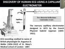 12 Lead ECG - An Introduction and Brief History - Dr Khaitan