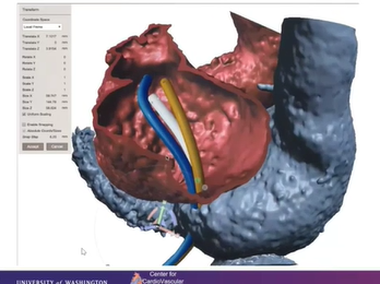 3D Printing and Virtual Planning For Clinical Care Innovation