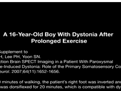A 16-Year-Old Boy With Dystonia After Prolonged Exercise A 16-Year-Old Boy With Dystonia After Prolonged Exercise