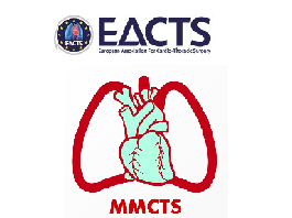 A novel technique to exclude the left ventricle with an assist device