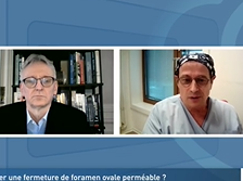 A qui proposer une fermeture de foramen ovale perméable ?