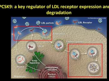 A Real World Approach to LDL cholesterol using PCSK9 inhibitors