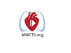 A safe and reproducible method to correct a d-transposition of the great arteries A safe and reproducible method to correct a d-transposition of the great arteries