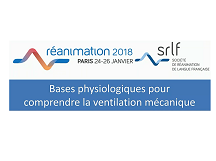 ABCD'air : les bases de la ventilation mécanique