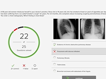 Abdominal Regions - Anatomy Abdominal Regions - Anatomy
