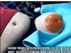 Abscessed Amputee Emergency Room Treatment (Roboot)