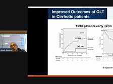AC21 - R. Mark Ghobrial: Liver Transplantation for Intrahepatic Cholangiocarcinoma AC21 - R. Mark Ghobrial: Liver Transplantation for Intrahepatic Cholangiocarcinoma