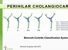 AC21 - Ryan Fields: Definition of Perihilar Cholangiocarcinoma AC21 - Ryan Fields: Definition of Perihilar Cholangiocarcinoma
