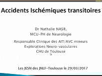 Accident ischemique transitoire Accident ischemique transitoire
