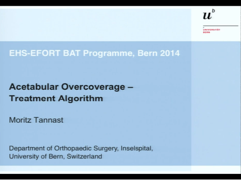 Acetabular overcoverage - treatment algorithm