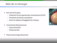 Actualités Neurovasculaire D. BRESSON Actualités Neurovasculaire D. BRESSON