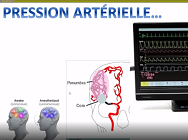 Actualités Neurovasculaire M. MAZIGHI Actualités Neurovasculaire M. MAZIGHI
