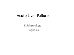Acute liver failure - Epidemiology and diagnosis