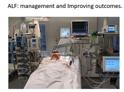 Acute liver failure - Extracorporeal liver assist devices