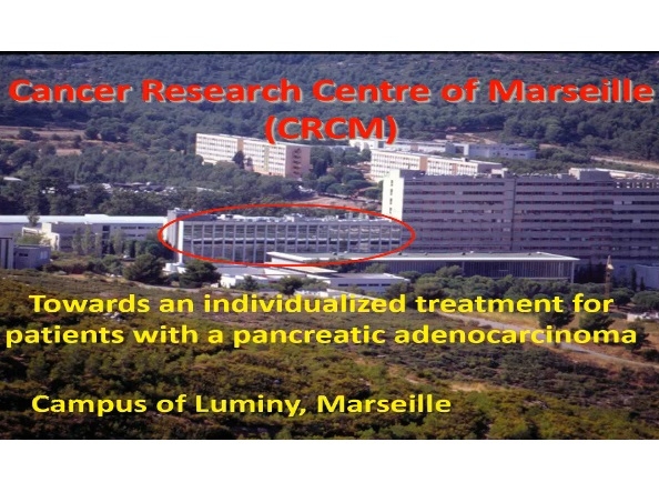 Adénocarcinome du Pancréas vers une thérapie personnalisée