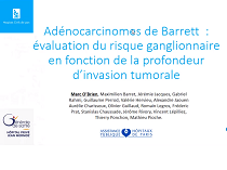Adénocarcinomes superficiels développés sur oesophage de Barrett : analyse rétrospective du risque ganglionnaire après mesure précise de la profondeur d'invasion tumorale