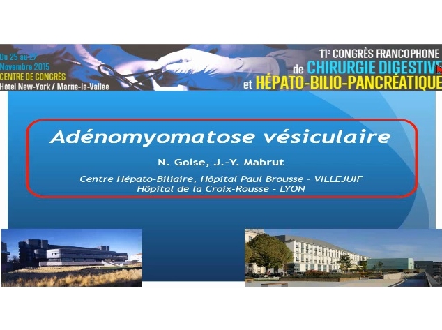 Adénomyose vésiculaire