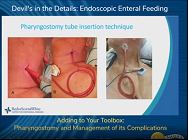 Adding to Your Toolbox: Pharyngostomy and Management of its Complications