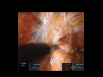 Adoption of a New Robotic Platform