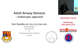 Adult airway stenosis endoscopy
