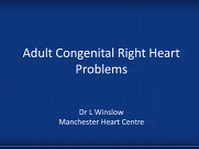Adult congenital right heart problems