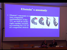 Advanced repair of atrioventricular valves : Ebstein & congenital mitral valve disease Advanced repair of atrioventricular valves : Ebstein & congenital mitral valve disease
