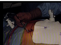 Advanced Ventral Hernia Repair Session: Tips And Tricks To Open And Laparoscopic Repair Advanced Ventral Hernia Repair Session: Tips And Tricks To Open And Laparoscopic Repair