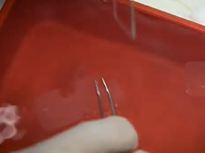 Agendia: Finding the Right Fit for Every Patient