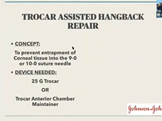 AIOS -IIRSI INTERACTIVE International Webinar on "Iris Repair Techniques"