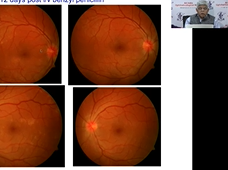 AIOS Live Webinar By Dr. Amod Gupta
