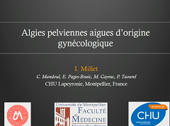 Algies pelviennes aigues d'origine gynécologique (sauf infection)