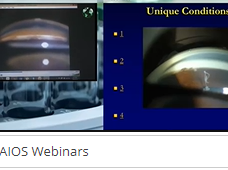 "All about Gonioscopy" -Dr. Tanuj Dada