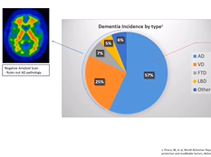 Alzheimer Europe, Yunus Msayib: Representing dementia pathology with autogenerated Biomarker Reports Alzheimer Europe, Yunus Msayib: Representing dementia pathology with autogenerated Biomarker Reports