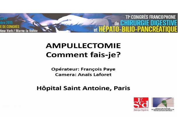 Ampullectomie chirurgicale