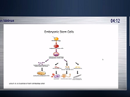 An Introduction to RPE Transplantation