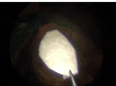 An Ovine Model For Endoscopic Ear Surgery Training