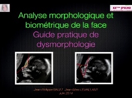 Analyse morphologique et biométrique de la face chez le fœtus Analyse morphologique et biométrique de la face chez le fœtus