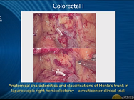 Anatomical characteristics and classifications of Henles trunk in laparoscopic right hemicolectomy Anatomical characteristics and classifications of Henles trunk in laparoscopic right hemicolectomy