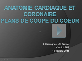 Anatomie cardiaque et coronaire ; Plans de coupe du cœur