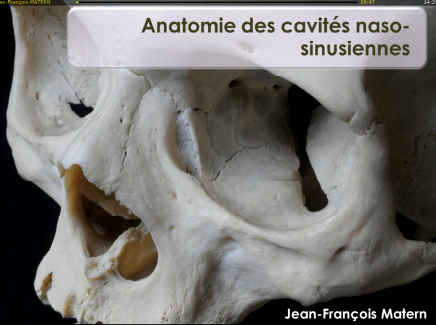 Anatomie des sinus et variantes anatomiques