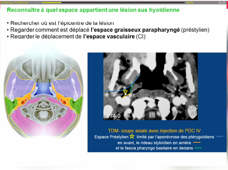 Anatomie et pathologie des espaces profonds