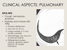 ANCA Associated Vasculitides: Clinical Aspects