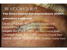 And a Tooth for an Eye: The Osteo-Odonto-Keratoprosthesis Procedure Explained And a Tooth for an Eye: The Osteo-Odonto-Keratoprosthesis Procedure Explained