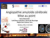 Angiopathie amyloïde