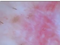 Angular Dependence of Polarized Light