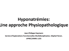 Anomalies métaboliques : comment raisonner - Hyponatrémie