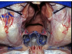 Anterior Skull Base, Part 1 (3D)