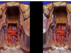 Anterior Skull Base, Part 1