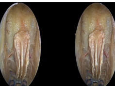 Anterior Skull Base, Part 2 (3D)