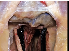 Anterior Skull Base, Part 2